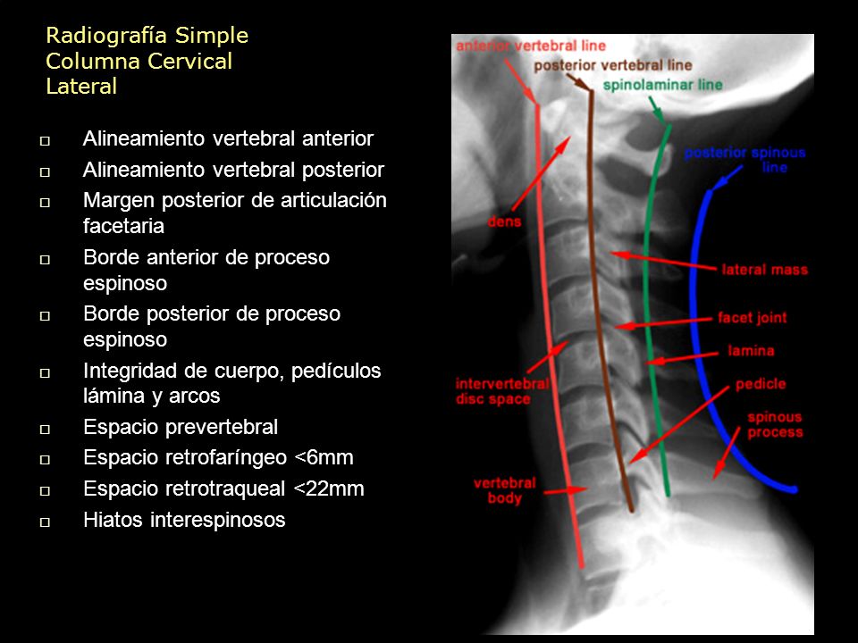 Los dolores en el cuello y la nuca a los cargamentos